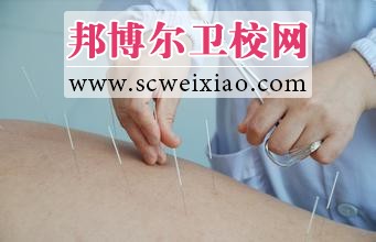 针灸治疗注意事项有哪些
