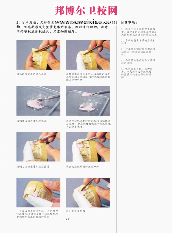 固定义齿的制作步骤